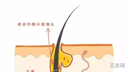 衍生物怎么理解(衍生物是指什么)